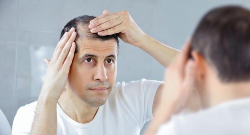 6 أسباب تؤدي إلى تساقط الشعر المفاجئ